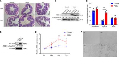 Hypomethylated interferon regulatory factor 8 recruits activating protein-2α to attenuate porcine epidemic diarrhea virus infection in porcine jejunum